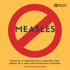 Measles Outbreak Raises Concerns Across the Nation